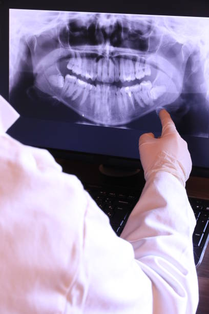 Best Emergency Dental Care for Broken or Chipped Teeth in Crosbyton, TX